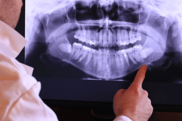 Best Emergency Treatment for Toothache in Ironton, MO